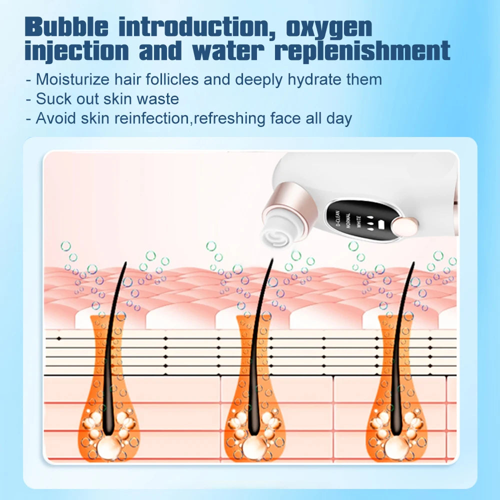 Electric Bubble Blackhead Remover Vacuum Suction Pore