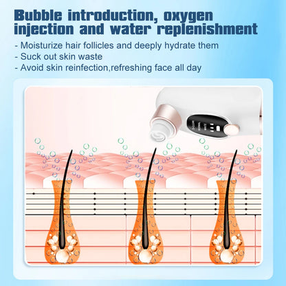 Electric Bubble Blackhead Remover Vacuum Suction Pore
