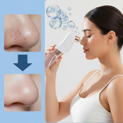 Electric Bubble Blackhead Remover Vacuum Suction Pore
